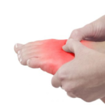 arthrose im fuß was hilft hausmittel